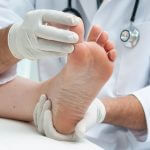 doctor checking for toenail fungus 150x150